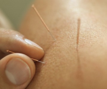 Investigación del dolor en Medicina Complementaria y Alternativa en Australia