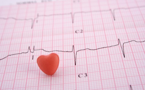 ECG durante telemonitorización domiciliaria