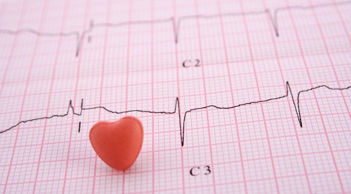 ECG durante telemonitorización domiciliaria