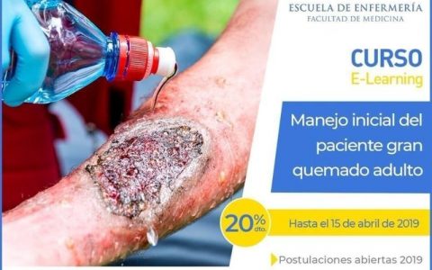 Curso de Manejo Inicial del Paciente Gran Quemado Adulto
